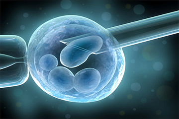 反复流产案例
